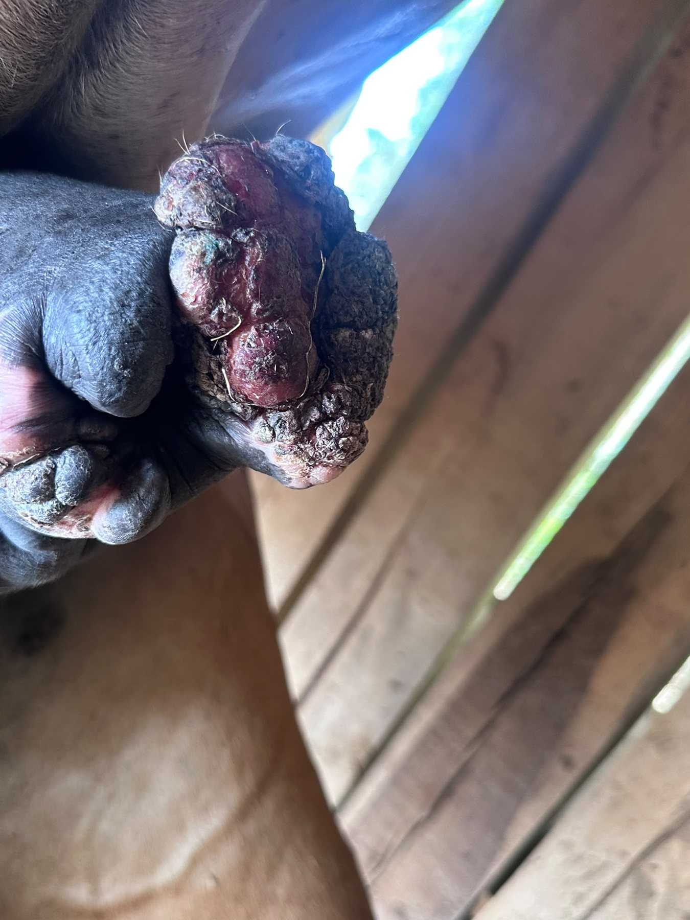 Oríkove sarkoidy — penis, 11. 8. 2026