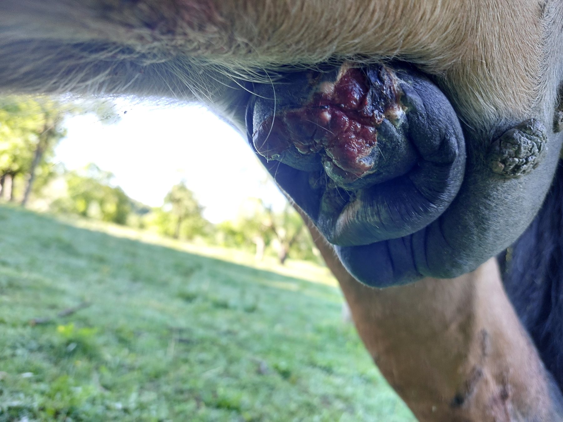 Oríkove sarkoidy — predkožka — recidíva, 19. 5. 2026